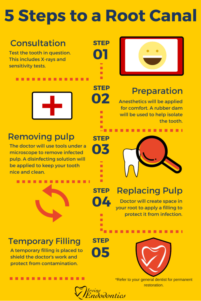 5 Steps to a Root Canal 1