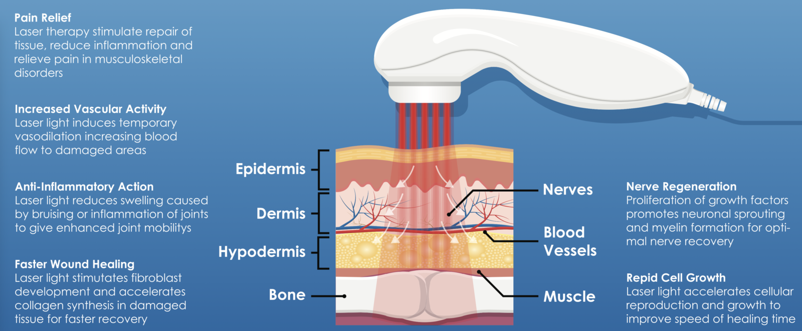 Schematic explanation of how biostimulation laser work