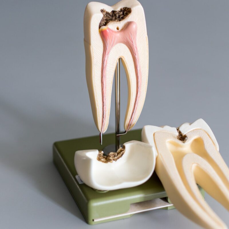Model of the interior of a tooth