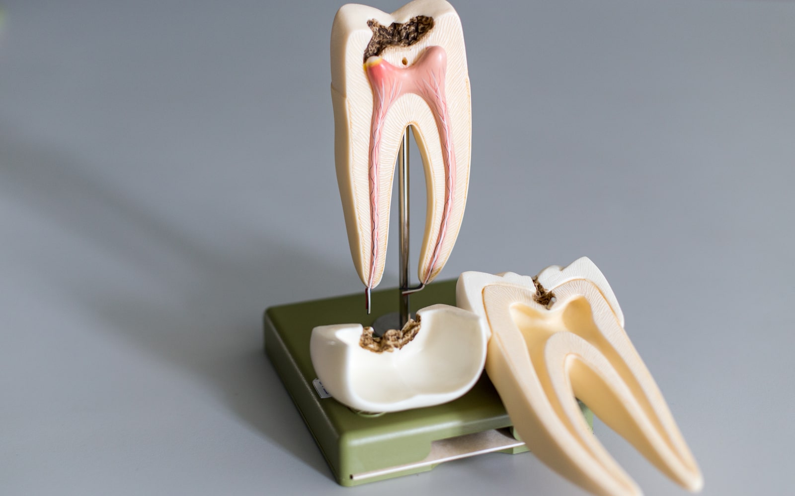 Model of the interior of a tooth