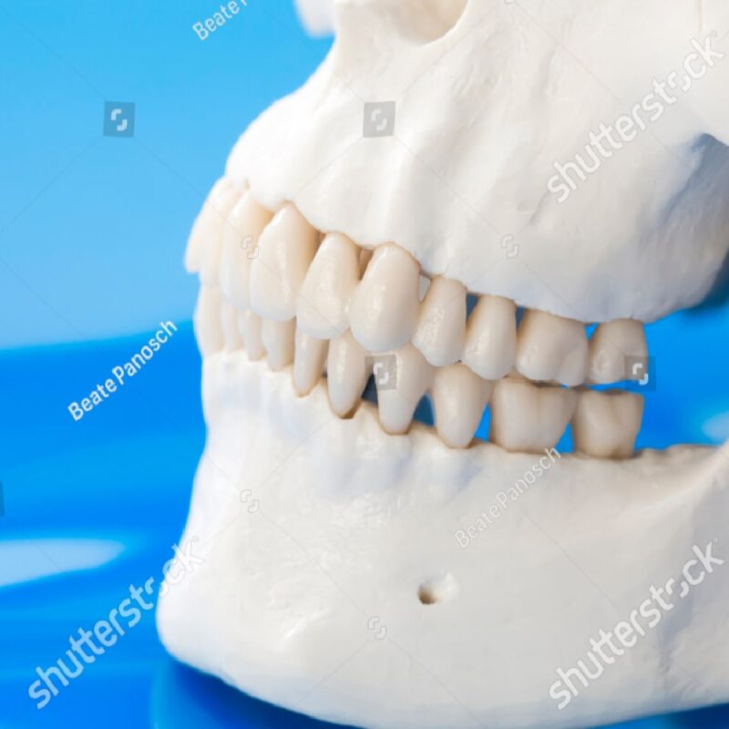 Jawbone Model