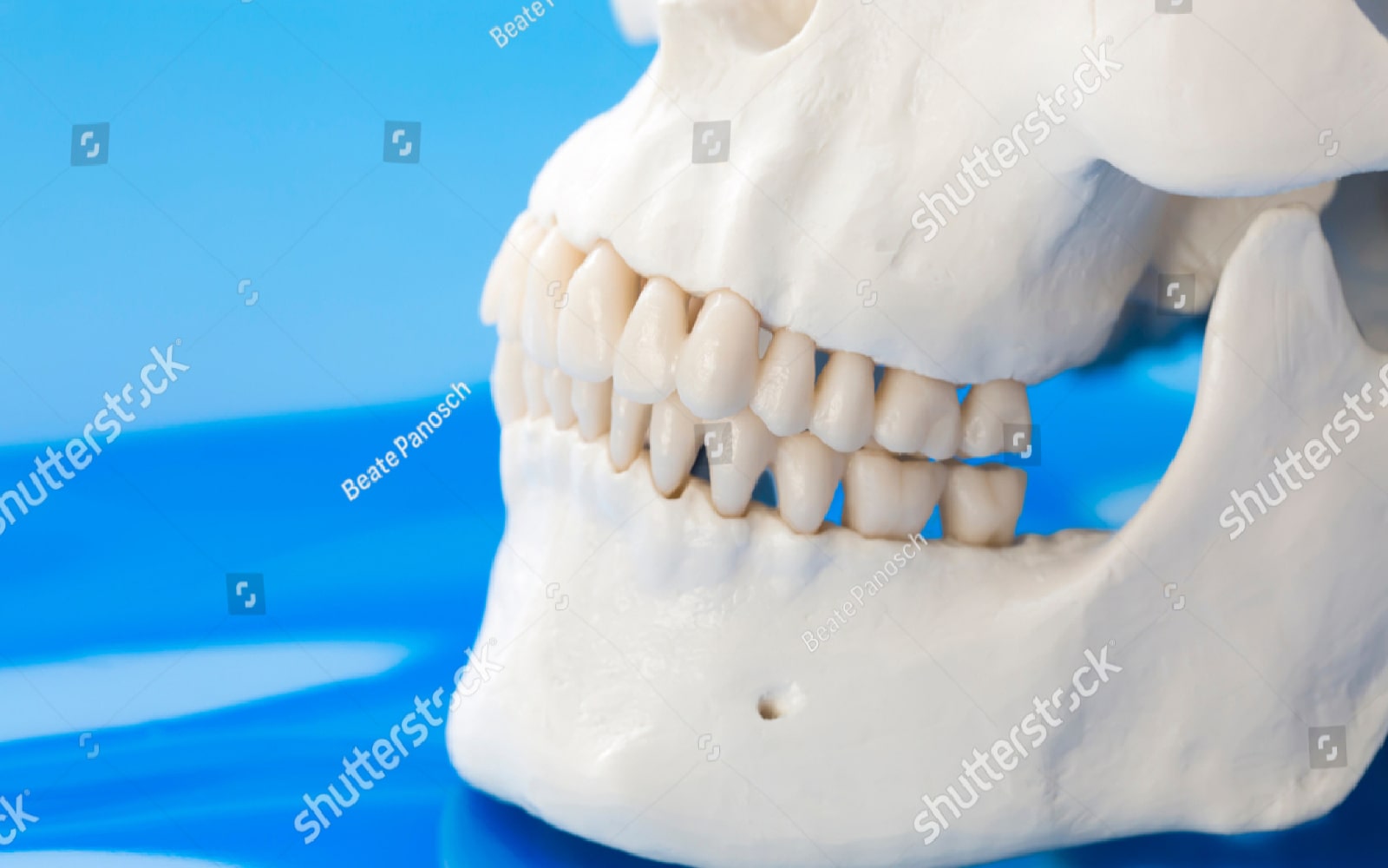 Jawbone Model