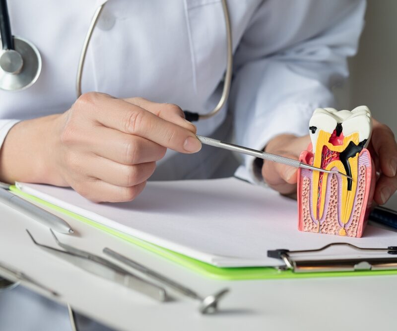 The dentist shows the disease and the formation of the tooth pulp.