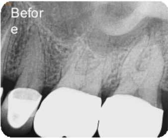 Dental X-ray before treatment.