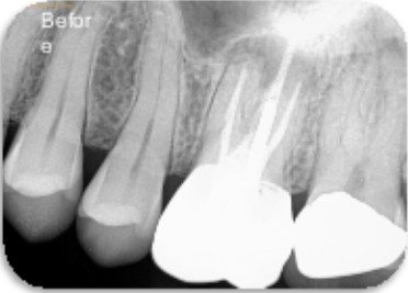 CBCT image 1.