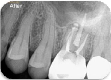 CBCT image 2.