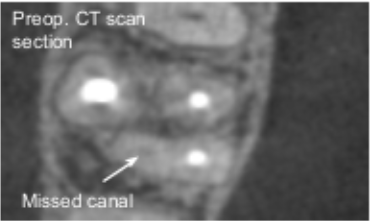 CBCT image 3.
