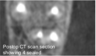 CBCT image 4.